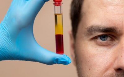 Platelet-Rich Plasma (PRP)